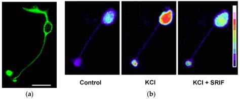 Molecular and Cellular Mechanisms Underlying Somatostatin-Based ...