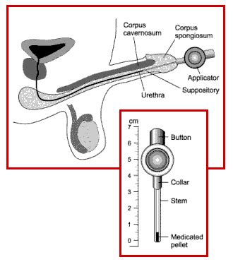 Using Muse Suppository 的图像结果