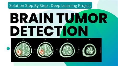 Image result for Deep Learning Algorithms Brain Tumor