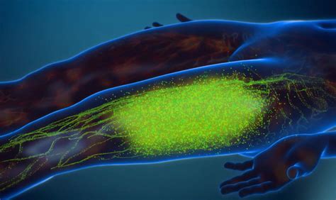 Image result for Linear Compression Wave Therapy