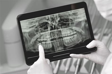 Radioprotection dentaire : obligations, bonnes pratiques et conformité - OCRP Expertise