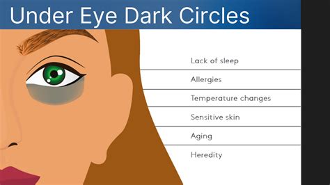 The Best Treatment For Dark Circles Under Eyes Cheap Order, Save 40% ...