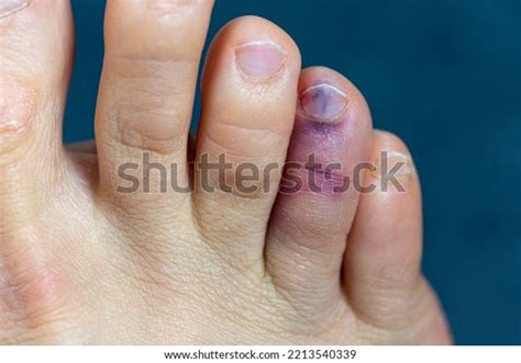 Image result for Front View of Toe