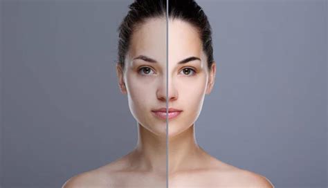 6 Natural Ways To Treat Uneven Skin Tone - lifeberrys.com