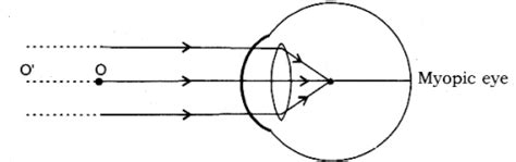 A 14 year old student is not able to see clearly the question’s 1. Name ...