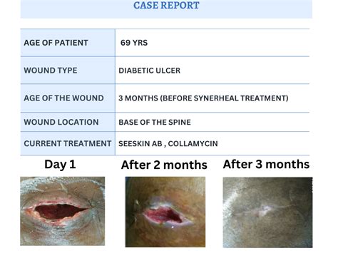 Case_report – Synerheal Pharmaceuticals