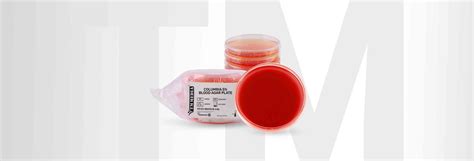 COLUMBIA 5% BLOOD AGAR PLATE – TM Media