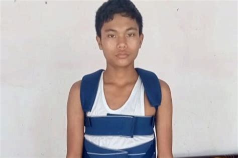 14 साल के किशोर की रीढ़ की हड्डी का जटिल ऑपरेशन कर दिया नया जीवन - PNI News