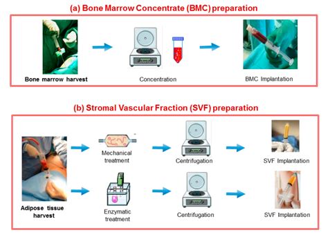 Articular Cartilage Regeneration in Osteoarthritis