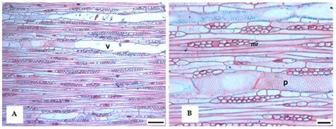 Linking Dendrometry and Dendrochronology in the Dominant Azorean Tree ...