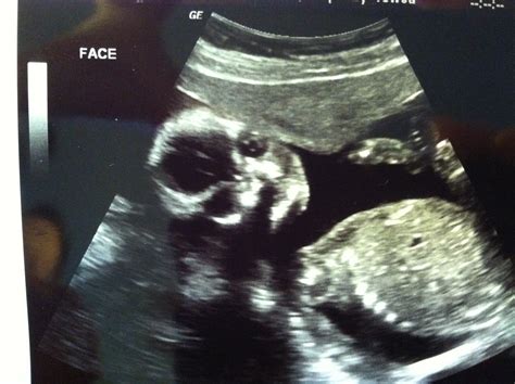 Image result for Alien Ultrasound