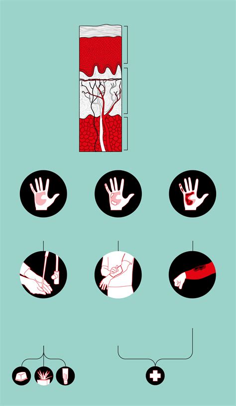 Conoce cómo actuar para dar los primeros auxilios en una emergencia