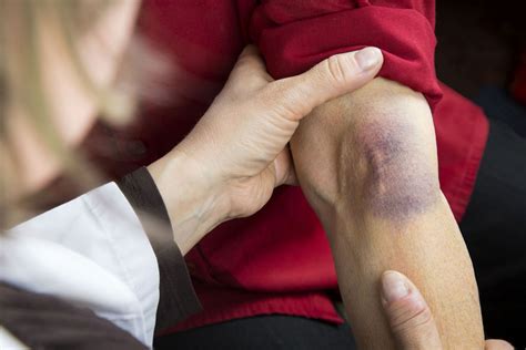 Difficult IV Access | B. Braun Australia - B. Braun