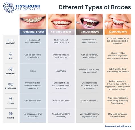 Types of Braces - Tisseront Orthodontics