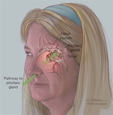AI's role in pituitary gland surgery | Yasaman Mansoori posted on the ...