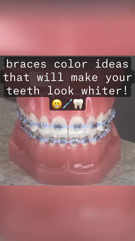 What Colors Make My Teeth Look Whiter at Delia Garibay blog