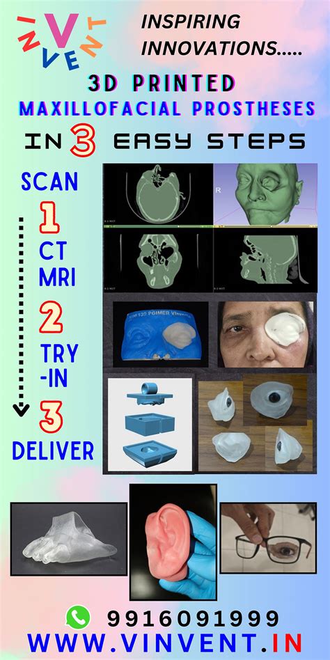 Digital Maxillofacial Prostheses in 3 Easy Steps