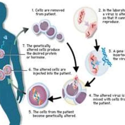 Gene Therapy 的图像结果