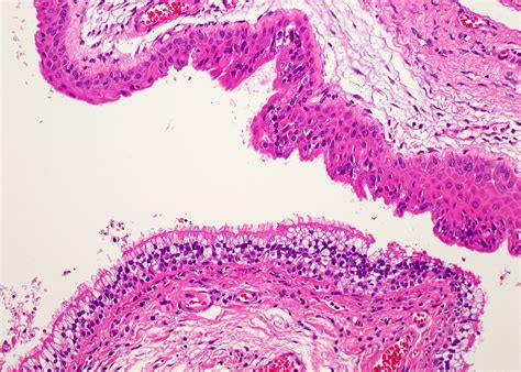 Papillary Duct Histology