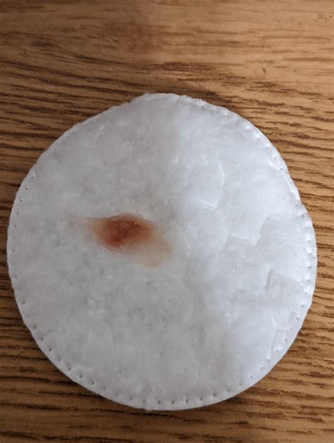 coughing up red/brown chunks of mucous : r/medical