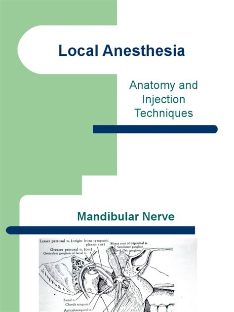 Local Anesthesia 的图像结果