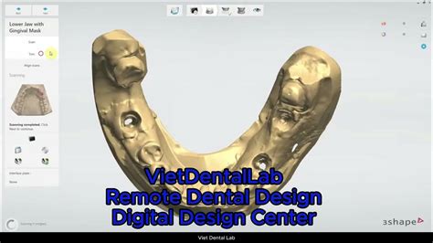 Image result for 3Shape How To