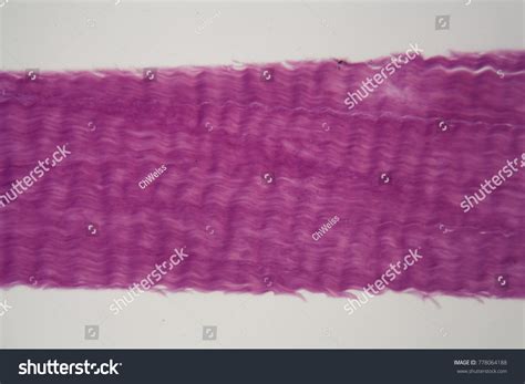 Section Dense Connective Tissue Under Microscope Stock Photo 778064188 ...