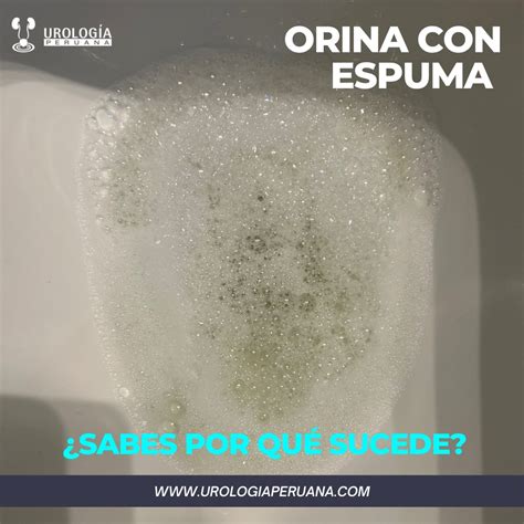 Espuma En La Orina