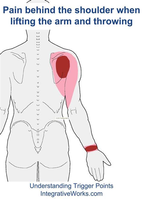 Pain Behind the Shoulder When Lifting Arm - Integrative Works