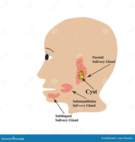 Parotid Salivary Gland Cyst. The Structure Of The Parotid Salivary Gland. Vector Illustration On ...