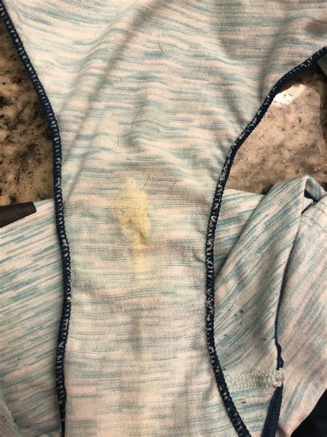 Yellow Discharge In Underwear Another Discharge Concern Sorry!!