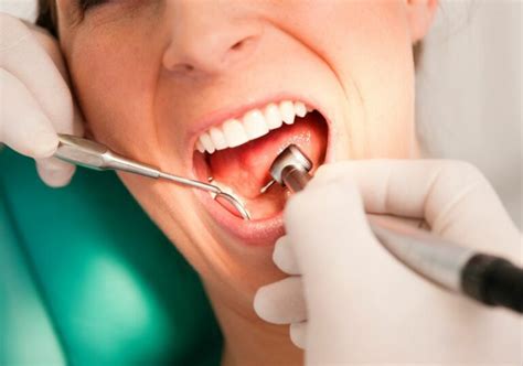 Tooth Extraction 的图像结果