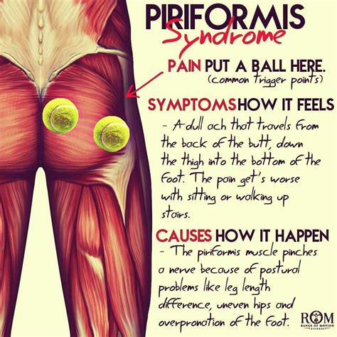 Piriformis syndrome exercises videos helping a pain in the butt – Artofit