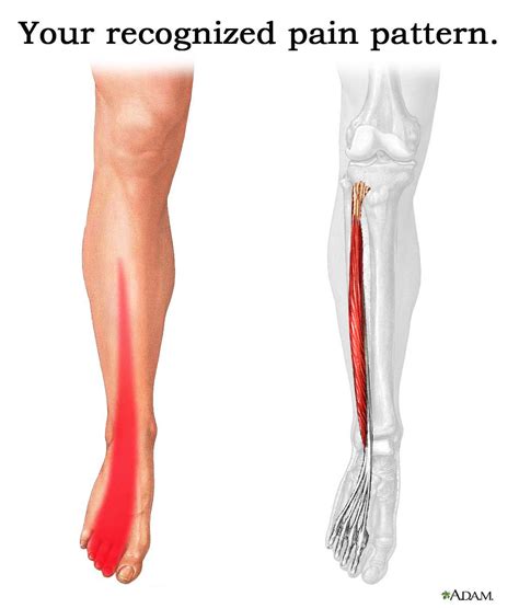 Pain relief...naturally