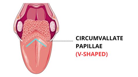 Multiple Bumps on the Back of Your Tongue? Most Likely Reasons