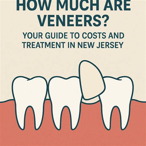 How Much Are Veneers? Your Guide to Costs and Treatment in New Jersey