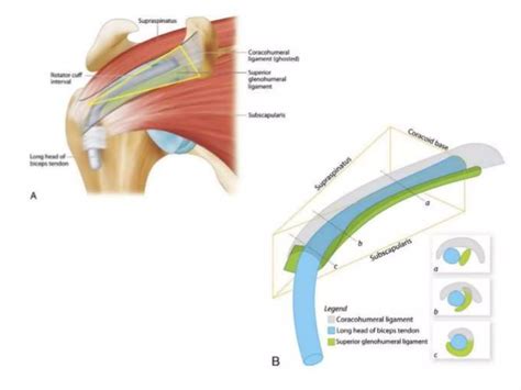 Shoulder impingement syndrome | PPTX