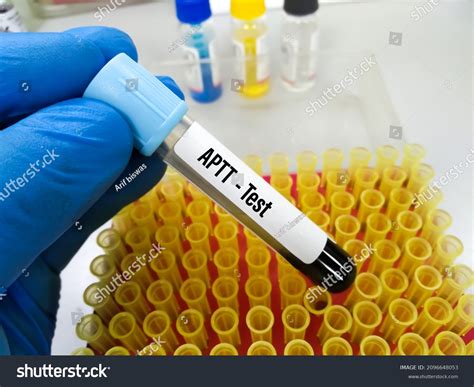 816 Blood Coagulation Patient Images, Stock Photos & Vectors | Shutterstock