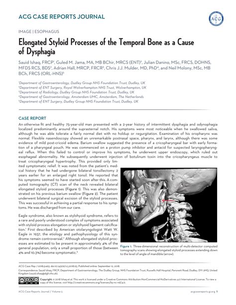 Image result for Functionality of the Styloid Process of Temporal Lobe