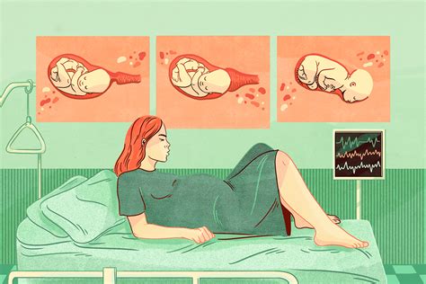 Dilation: Symptoms, Phases, and Complications