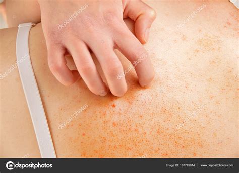 Image result for Intense Back Scratching