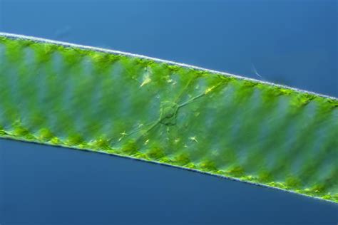 Spirogyra Under Microscope
