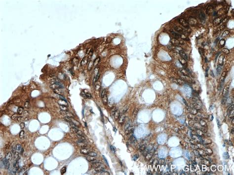 BCL2L1 antibody (66020-1-Ig) | Proteintech