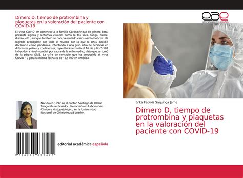 Buy Dímero D, tiempo de protrombina y plaquetas en la valoración del ...