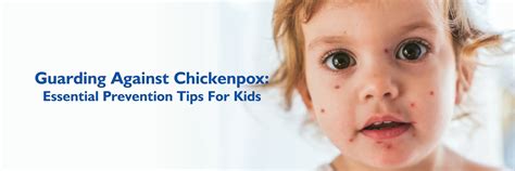 Chicken Pox Prevention What Are The Causes And Symptoms Of Chicken
