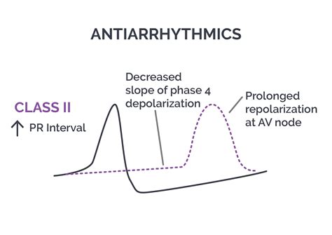Antiarrhythmics | Important drugs of the cardiovascular system | Pharmacology | Achievable USMLE/1