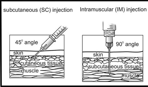 Angle of Injection 的图像结果
