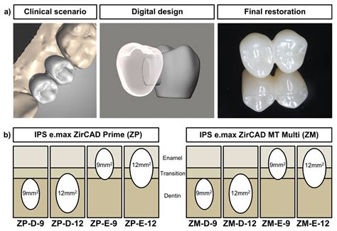 Types Of Zirconia at Leah Woodcock blog