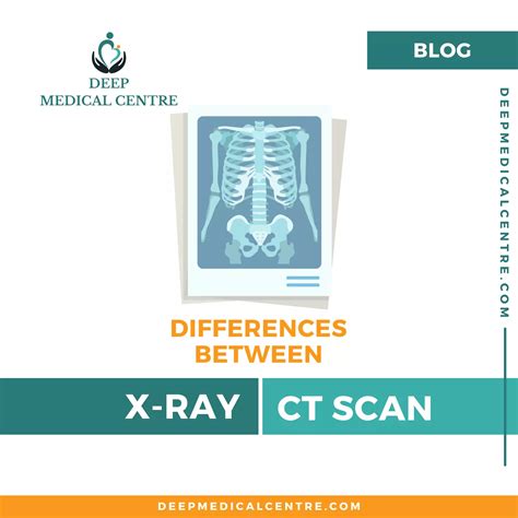 7 Differences Between X Ray And CT Scan - Deep Medical Centre