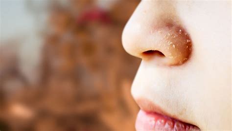 7 Major Summer Skin Problems That Strip Off Your Glow | Uniqaya ...